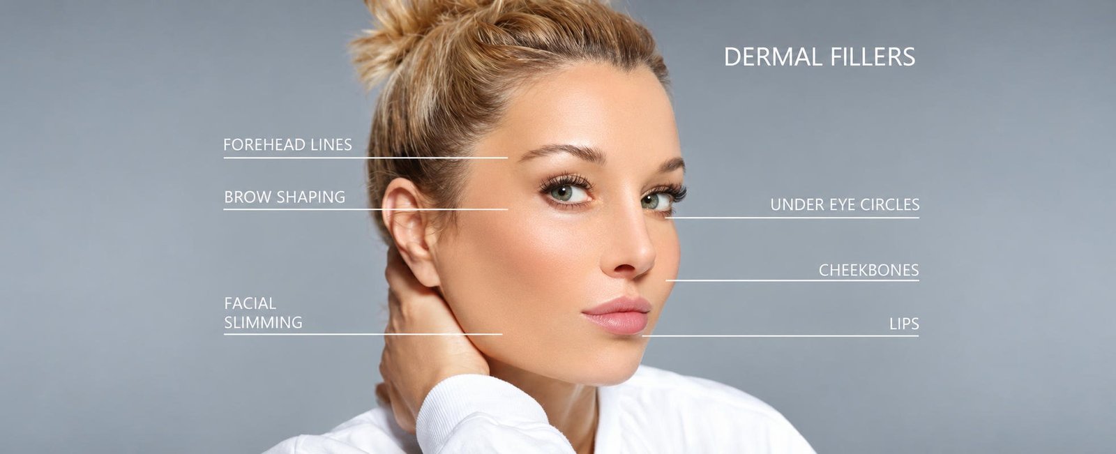 Dermal filler treatment areas mapped on a woman's face, including under-eye circles, cheekbones and lips